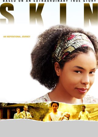 《困膚》電影海報