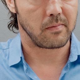 Engin Benli 飾演 Doktor